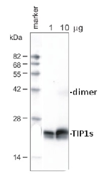 TIP1;1, TIP1;2 | tonoplast intrinistic protein 1-1, 1-2 (gamma) in the group Antibodies Plant/Algal / Membrane Transport System / Vacuolar membrane at Agrisera AB (Antibodies for research) (AS09 493)